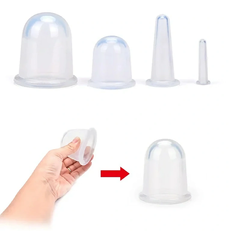 Terapija ventuzama za smanjenje masnoće i celulita